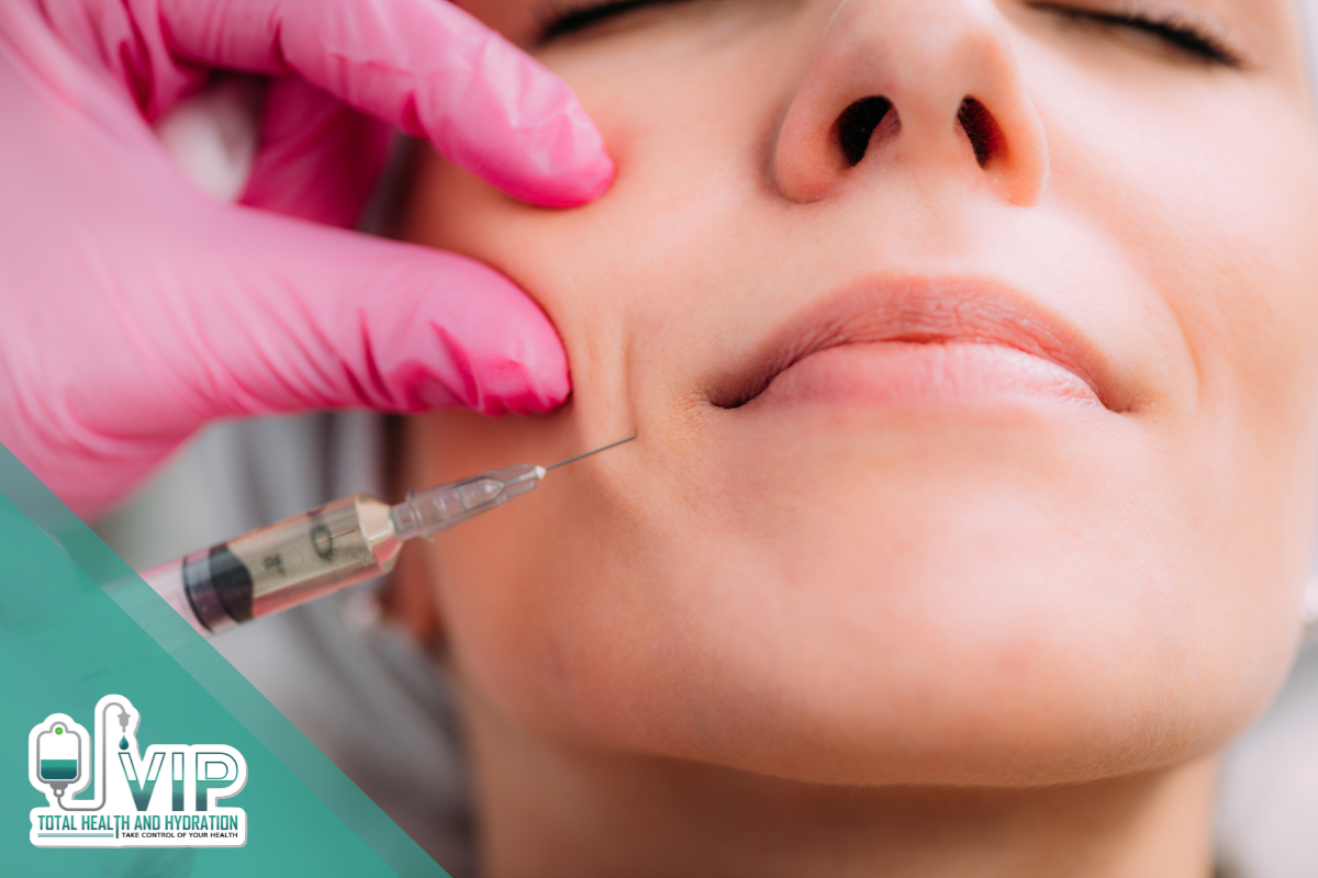 Smile Line Fillers: Our Top 2 Treatment Options