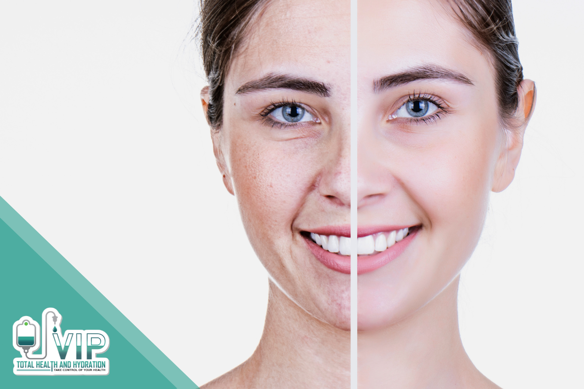 What is microneedling?