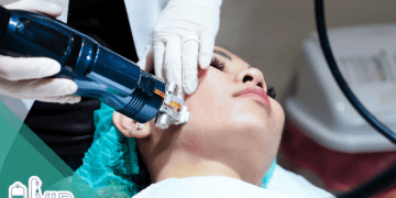 Microneedling aftercare: What to expect after Morpheus8 treatment
