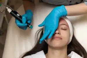 Fort Worth facial treatments
