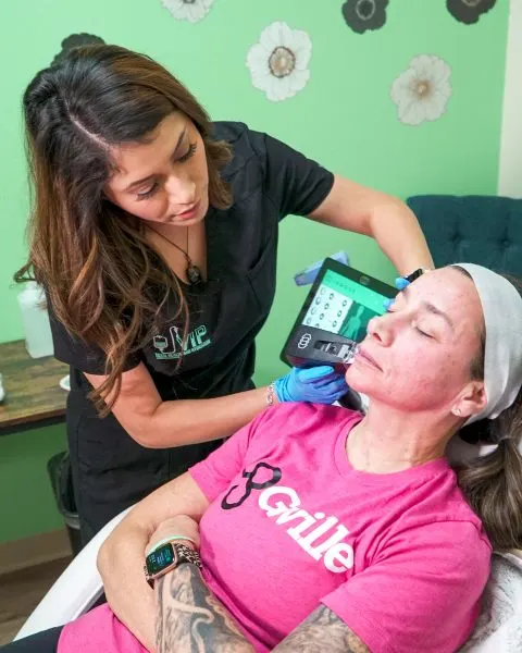 Morpheus8 RF Microneedling