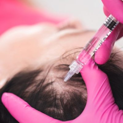 PRP Injection PRP Injection